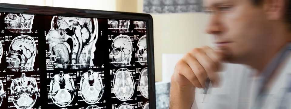 Escalas neurológicas y vasculopatías cerebrales: TAC de cabeza y cuello.